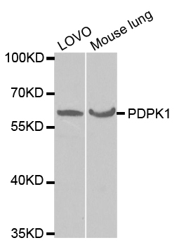 PDPK1 / PDK1 Antibody - Western blot analysis of extracts of various cell lines, using PDPK1 antibody.
