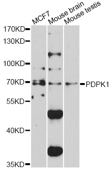 PDPK1 / PDK1 Antibody - Western blot analysis of extracts of various cell lines, using PDPK1 antibody at 1:500 dilution. The secondary antibody used was an HRP Goat Anti-Rabbit IgG (H+L) at 1:10000 dilution. Lysates were loaded 25ug per lane and 3% nonfat dry milk in TBST was used for blocking. An ECL Kit was used for detection and the exposure time was 90s.