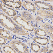 PDPK1 / PDK1 Antibody - Immunohistochemistry of paraffin-embedded human kidney using PDPK1 Antibodyat dilution of 1:200 (40x lens).
