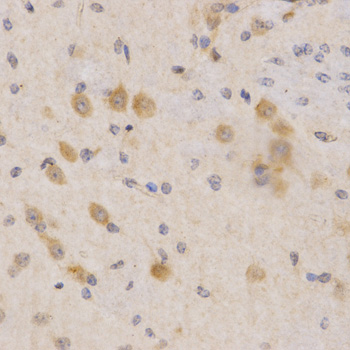 PDPK1 / PDK1 Antibody - Immunohistochemistry of paraffin-embedded mouse brain using PDPK1 Antibodyat dilution of 1:200 (40x lens).