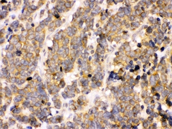 PDPK1 / PDK1 Antibody