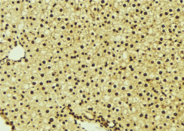 PDPK1 / PDK1 Antibody - 1:100 staining mouse liver tissue by IHC-P. The sample was formaldehyde fixed and a heat mediated antigen retrieval step in citrate buffer was performed. The sample was then blocked and incubated with the antibody for 1.5 hours at 22°C. An HRP conjugated goat anti-rabbit antibody was used as the secondary.
