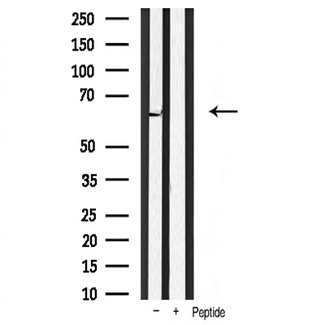 PDPK1 / PDK1 Antibody - Western blot analysis of PDK1 expression in mouse heart tissue lysates. The lane on the right is treated with the antigen-specific peptide.