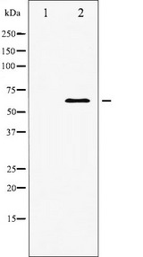 PDPK1 / PDK1 Antibody - Western blot analysis of PDK1 expression in EGF treated MDA-MB-435 whole cells lysates. The lane on the left is treated with the antigen-specific peptide.