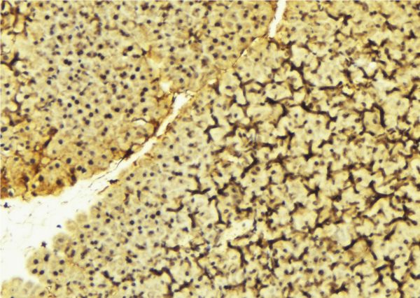 PDPK1 / PDK1 Antibody - 1:100 staining mouse liver tissue by IHC-P. The sample was formaldehyde fixed and a heat mediated antigen retrieval step in citrate buffer was performed. The sample was then blocked and incubated with the antibody for 1.5 hours at 22°C. An HRP conjugated goat anti-rabbit antibody was used as the secondary.