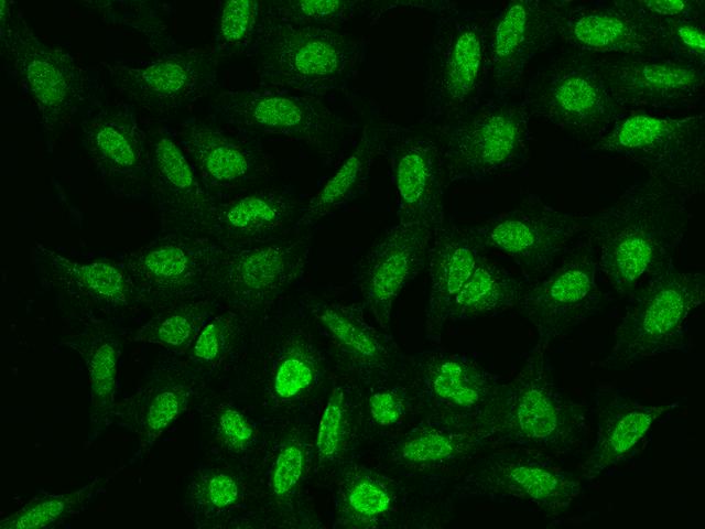 PDPK1 / PDK1 Antibody - Immunofluorescence staining of PDPK1 in U2OS cells. Cells were fixed with 4% PFA, permeabilzed with 0.1% Triton X-100 in PBS, blocked with 10% serum, and incubated with rabbit anti-Human PDPK1 polyclonal antibody (dilution ratio 1:200) at 4°C overnight. Then cells were stained with the Alexa Fluor 488-conjugated Goat Anti-rabbit IgG secondary antibody (green). Positive staining was localized to Nucleus.