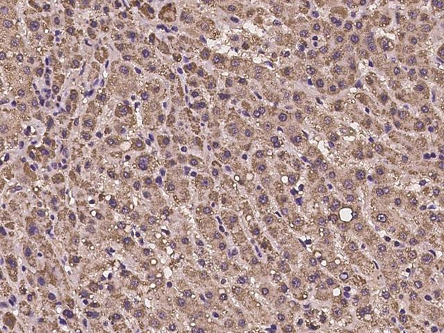 PDPK1 / PDK1 Antibody - Immunochemical staining of human PDPK1 in human liver with rabbit polyclonal antibody at 1:100 dilution, formalin-fixed paraffin embedded sections.