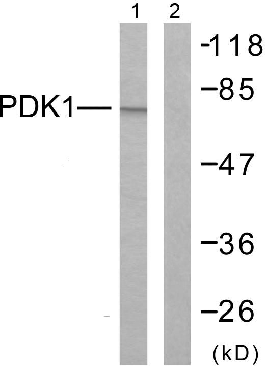 PDPK1 / PDK1 Antibody - Western blot analysis of extracts from MDA-MB-435 cells using PDK1 (Ab-241) antibody.