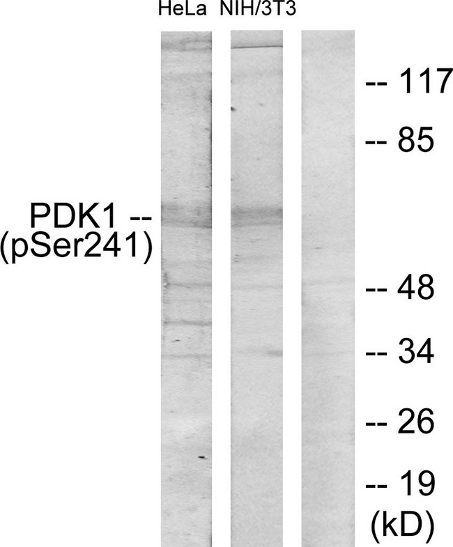 PDPK1 / PDK1 Antibody - Western blot analysis of lysates from HeLa cells and NIH/3T3 cells, using PDK1 (Phospho-Ser241) Antibody. The lane on the right is blocked with the phospho peptide.