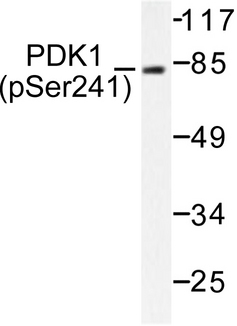 PDPK1 / PDK1 Antibody - Western blot of p-PDK1 (S241) pAb in extracts from MDA-MB-435 cells treated with EGF.