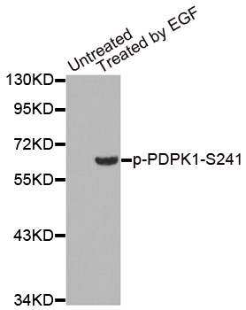 PDPK1 / PDK1 Antibody - Western blot analysis of extracts from 293 cells.