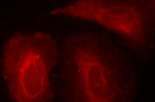 PDPK1 / PDK1 Antibody - Immunofluorescence staining of methanol-fixed Hela cells.