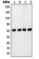 PDPK1 / PDK1 Antibody - Western blot analysis of PDPK1 (pS241) expression in HeLa (A); MCF7 (B); NIH3T3 (C); PC12 EGF-treated (D) whole cell lysates.