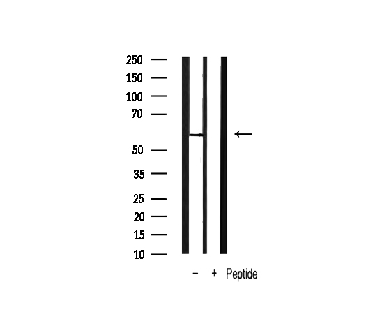 PDPK1 / PDK1 Antibody - Western blot analysis of PDK1 phosphorylation expression in mouse liver tissue lysates. The lane on the right is treated with the antigen-specific peptide.
