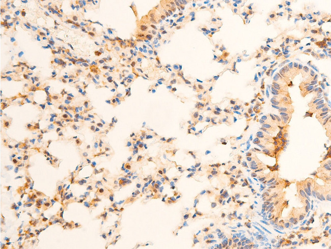 PDPK1 / PDK1 Antibody - 1:100 staining mouse lung tissue by IHC-P. The tissue was formaldehyde fixed and a heat mediated antigen retrieval step in citrate buffer was performed. The tissue was then blocked and incubated with the antibody for 1.5 hours at 22°C. An HRP conjugated goat anti-rabbit antibody was used as the secondary.