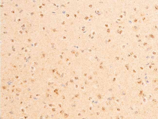 PDPK1 / PDK1 Antibody - 1:100 staining mouse brain tissue by IHC-P. The tissue was formaldehyde fixed and a heat mediated antigen retrieval step in citrate buffer was performed. The tissue was then blocked and incubated with the antibody for 1.5 hours at 22°C. An HRP conjugated goat anti-rabbit antibody was used as the secondary.