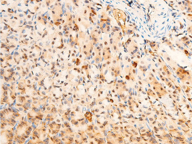 PDPK1 / PDK1 Antibody - 1:100 staining mouse gastric tissue by IHC-P. The tissue was formaldehyde fixed and a heat mediated antigen retrieval step in citrate buffer was performed. The tissue was then blocked and incubated with the antibody for 1.5 hours at 22°C. An HRP conjugated goat anti-rabbit antibody was used as the secondary.