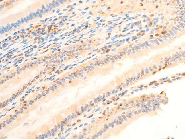 PDPK1 / PDK1 Antibody - 1:100 staining rat Intestinal tissue by IHC-P. The tissue was formaldehyde fixed and a heat mediated antigen retrieval step in citrate buffer was performed. The tissue was then blocked and incubated with the antibody for 1.5 hours at 22°C. An HRP conjugated goat anti-rabbit antibody was used as the secondary.