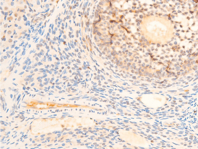 PDPK1 / PDK1 Antibody - 1:100 staining rat ovarian tissue by IHC-P. The tissue was formaldehyde fixed and a heat mediated antigen retrieval step in citrate buffer was performed. The tissue was then blocked and incubated with the antibody for 1.5 hours at 22°C. An HRP conjugated goat anti-rabbit antibody was used as the secondary.