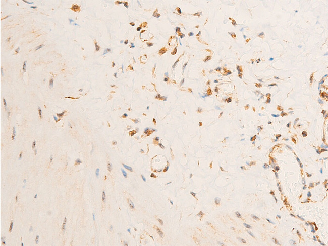 PDPK1 / PDK1 Antibody - 1:100 staining human gastric tissue by IHC-P. The tissue was formaldehyde fixed and a heat mediated antigen retrieval step in citrate buffer was performed. The tissue was then blocked and incubated with the antibody for 1.5 hours at 22°C. An HRP conjugated goat anti-rabbit antibody was used as the secondary.