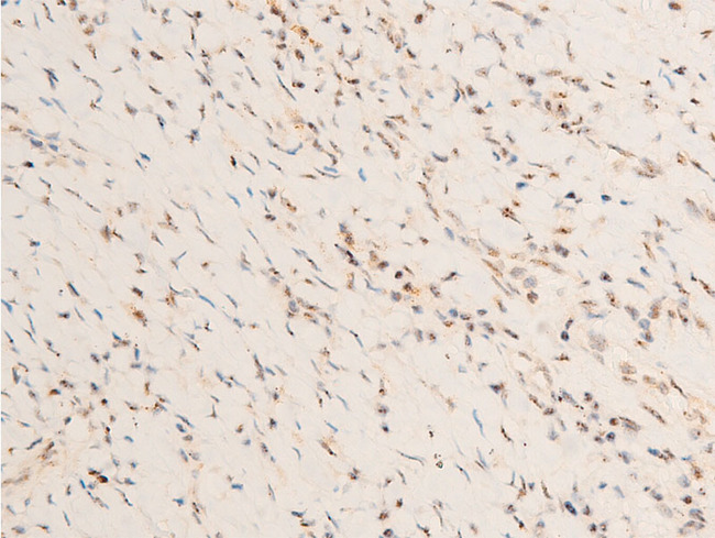 PDPK1 / PDK1 Antibody - 1:100 staining human TB tissue by IHC-P. The tissue was formaldehyde fixed and a heat mediated antigen retrieval step in citrate buffer was performed. The tissue was then blocked and incubated with the antibody for 1.5 hours at 22°C. An HRP conjugated goat anti-rabbit antibody was used as the secondary.