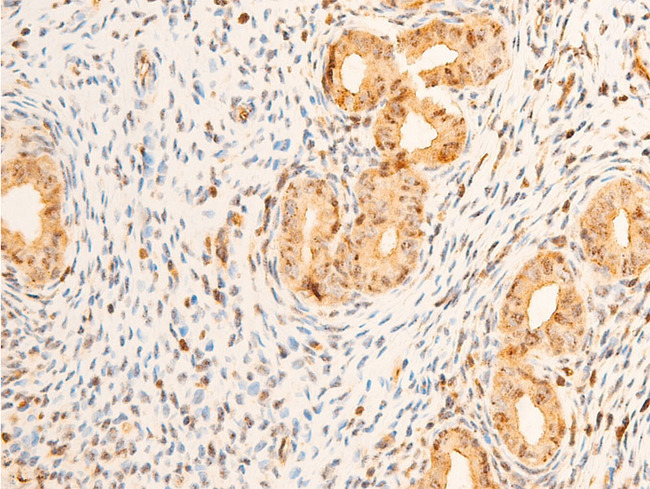 PDPK1 / PDK1 Antibody - 1:100 staining rat uterine tissue by IHC-P. The tissue was formaldehyde fixed and a heat mediated antigen retrieval step in citrate buffer was performed. The tissue was then blocked and incubated with the antibody for 1.5 hours at 22°C. An HRP conjugated goat anti-rabbit antibody was used as the secondary.