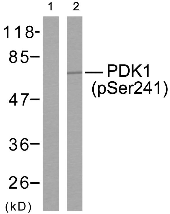 PDPK1 / PDK1 Antibody - Western blot analysis of extracts from MDA-MB-435 cells using PDK1 (phospho-Ser241) antibody.