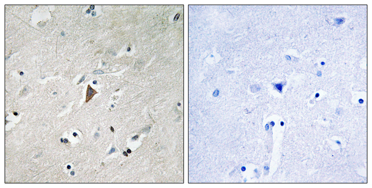 PDPK1 / PDK1 Antibody - Immunohistochemistry analysis of paraffin-embedded human brain, using PDK1 (Phospho-Tyr9) Antibody. The picture on the right is blocked with the phospho peptide.