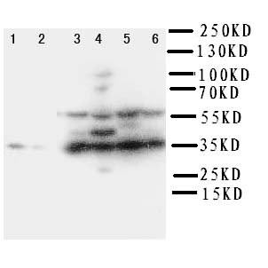 PDPN / Podoplanin Antibody - WB of PDPN / Podoplanin antibody. Lane 1: Rat Brain Tissue Lysate. Lane 2: Rat Liver Tissue Lysate. Lane 3: SMMC Cell Lysate. Lane 4: HEPA Cell Lysate. Lane 5: 293T Cell Lysate. Lane 6: HELA Cell Lysate.