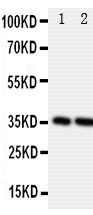 PDPN / Podoplanin Antibody - Anti-Podoplanin/gp36 antibody, Western blotting All lanes: Anti at 0.5ug/ml Lane 1: Rat Brain Tissue Lysate at 50ug Lane 2: Rat Liver Tissue Lysate at 50ug Predicted bind size: 17KD Observed bind size: 35KD
