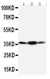 PDPN / Podoplanin Antibody - Anti-Podoplanin/gp36 antibody, Western blotting All lanes: Anti Podoplanin/gp36 at 0.5ug/ml Lane 1: SMMC Whole Cell Lysate at 40ugLane 2: 293T Whole Cell Lysate at 40ugLane 3: HELA Whole Cell Lysate at 40ugPredicted bind size: 36KD Observed bind size: 36KD