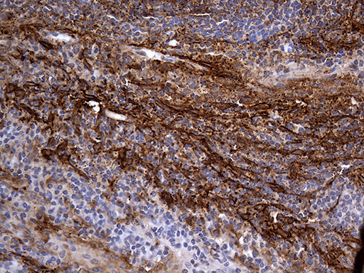 PDPN / Podoplanin Antibody - Immunohistochemical staining of paraffin-embedded Human tonsil within the normal limits using anti-PDPN mouse monoclonal antibody. (Heat-induced epitope retrieval by 1mM EDTA in 10mM Tris buffer. (pH8.5) at 120°C for 3 min. (1:2000)