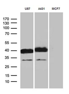 PDPN / Podoplanin Antibody - Western blot analysis of extracts. (35ug) from 3 different cell lines by using anti-PDPN monoclonal antibody. (1:500)
