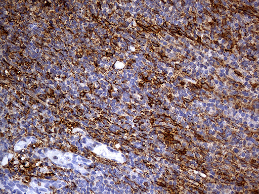 PDPN / Podoplanin Antibody - Immunohistochemical staining of paraffin-embedded Human tonsil within the normal limits using anti-PDPN mouse monoclonal antibody. (Heat-induced epitope retrieval by 1mM EDTA in 10mM Tris buffer. (pH8.5) at 120°C for 3 min. (1:500)