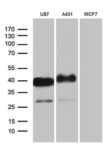 PDPN / Podoplanin Antibody - Western blot analysis of extracts. (35ug) from 3 different cell line by using anti-PDPN monoclonal antibody. (1:500)