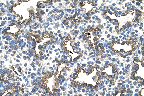 PDPN / Podoplanin Antibody - PDPN / Podoplanin antibody ARP44528_P050-NP_006465-PDPN(podoplanin) Antibody IHC of formalin-fixed, paraffin-embedded human Lung. Positive label: Alveolar cells indicated with arrows. Antibody concentration 4-8 ug/ml. Magnification 400X.  This image was taken for the unconjugated form of this product. Other forms have not been tested.