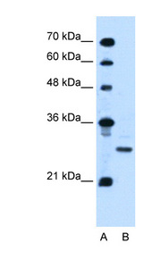 PDPN / Podoplanin Antibody - PDPN / Podoplanin antibody ARP44528_P050-NP_006465-PDPN(podoplanin) Antibody Western blot of Jurkat lysate.  This image was taken for the unconjugated form of this product. Other forms have not been tested.