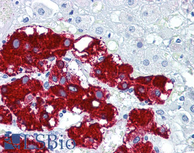 PDPN / Podoplanin Antibody - Anti-Podoplanin antibody IHC of human adrenal. Immunohistochemistry of formalin-fixed, paraffin-embedded tissue after heat-induced antigen retrieval. Antibody concentration 5 ug/ml.  This image was taken for the unconjugated form of this product. Other forms have not been tested.