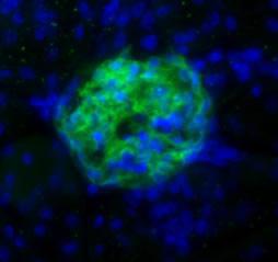 PDPN / Podoplanin Antibody - Podoplanin Antibody (8.1.1) - Lymphatic Endothelium Marker - Podoplanin (8.1.1) antibody labeling (green) of glomeruli from mouse kidney. Nuclei were counterstained with DAPI (blue).  This image was taken for the unconjugated form of this product. Other forms have not been tested.