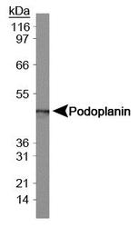 PDPN / Podoplanin Antibody - Podoplanin Antibody (8.1.1) - Western blot of Podoplanin in mouse kidney tissue extract.  This image was taken for the unconjugated form of this product. Other forms have not been tested.