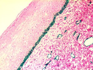 PDPN / Podoplanin Antibody - IHC of Podoplanin / D2-40 on an FFPE Tonsil Tissue