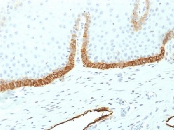 PDPN / Podoplanin Antibody - IHC testing of FFPE human cervical tissue with Poloplanin antibody (clone PDPN/1433). Required HIER: boil tissue sections in 10mM citrate buffer, pH 6, for 10-20 min followed by cooling at RT for 20 min.