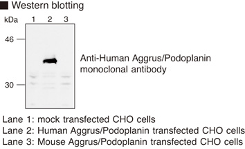 PDPN / Podoplanin Antibody