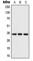 PDPN / Podoplanin Antibody - Western blot analysis of Podoplanin expression in HT1080 (A); Raw264.7 (B); PC12 (C) whole cell lysates.