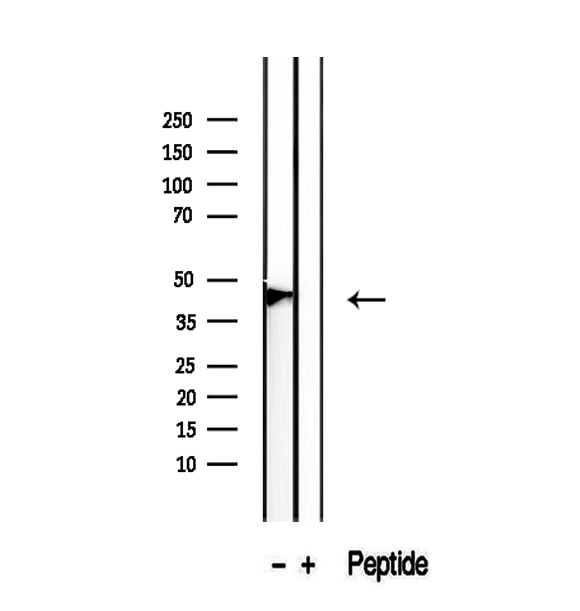 PDPN / Podoplanin Antibody - Western blot analysis of extracts of HEK293 cells using Podoplanin antibody.