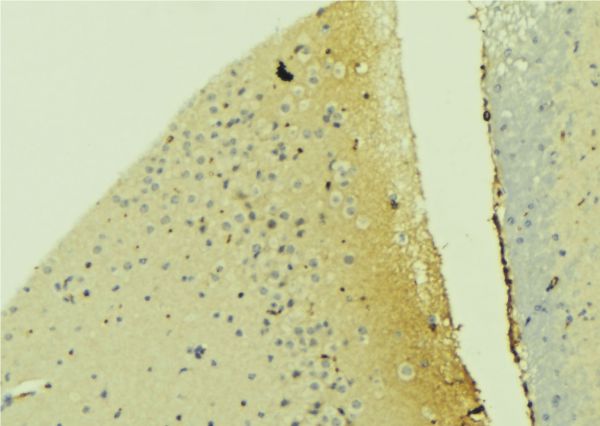 PDPN / Podoplanin Antibody - 1:100 staining mouse brain tissue by IHC-P. The sample was formaldehyde fixed and a heat mediated antigen retrieval step in citrate buffer was performed. The sample was then blocked and incubated with the antibody for 1.5 hours at 22°C. An HRP conjugated goat anti-rabbit antibody was used as the secondary.