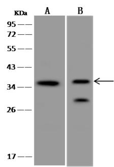 PDPN / Podoplanin Antibody - Anti-Podoplanin rabbit polyclonal antibody at 1:500 dilution. Lane A: HT1080 Whole Cell Lysate. Lane B: NCI-H460 Whole Cell Lysate. Lysates/proteins at 30 ug per lane. Secondary: Goat Anti-Rabbit IgG (H+L)/HRP at 1/10000 dilution. Developed using the ECL technique. Performed under reducing conditions. Predicted band size: 18 kDa. Observed band size: 36 kDa. (We are unsure as to the identity of these extra bands.)