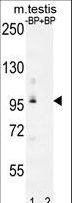 PDPR Antibody - Western blot of PDPR Antibody antibody pre-incubated without(lane 1) and with(lane 2) blocking peptide in mouse testis tissue lysate. PDPR Antibody (arrow) was detected using the purified antibody.