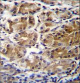 PDPR Antibody - PDPR Antibody immunohistochemistry of formalin-fixed and paraffin-embedded human stomach tissue followed by peroxidase-conjugated secondary antibody and DAB staining.