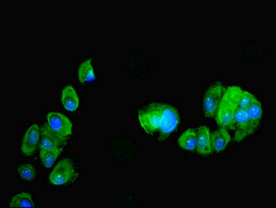 PDRG1 Antibody - Immunofluorescent analysis of MCF-7 cells using PDRG1 Antibody at dilution of 1:100 and Alexa Fluor 488-congugated AffiniPure Goat Anti-Rabbit IgG(H+L)